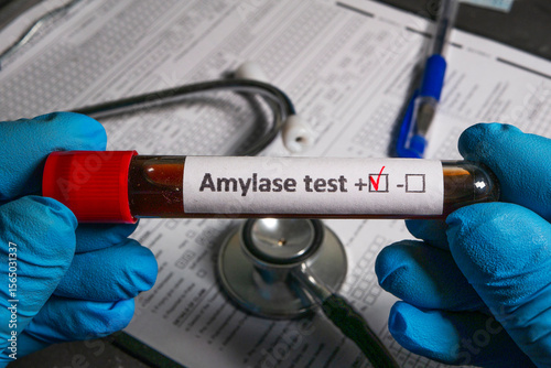 Blood sample testing amylase in laboratory, medical check up concept
