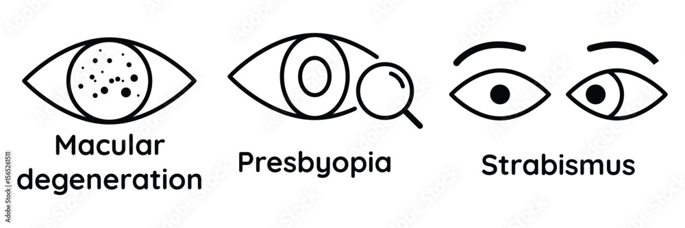 Ταπετσαρία Vision condition icon set showing macular degeneration presbyopia strabismus in modern minimal line style for healthcare awareness vector