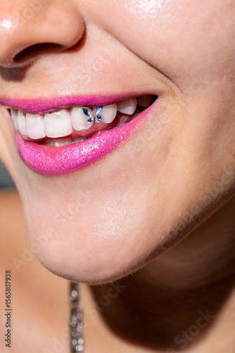 Woman showing her new tooth gems and pink lipstick