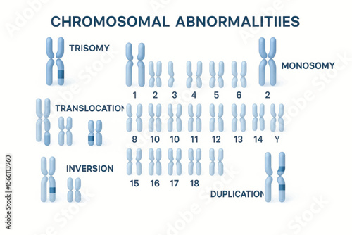 Vector medical illustration of chromosomal abnormalities including trisomy, monosomy, and duplication with clearly labeled chromosomes and numbers.