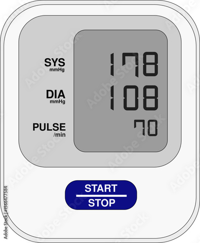 Vector Illustration of Digital Blood Pressure Monitor Showing High Blood Pressure – Hypertension Stage 2 with Elevated SYS and DIA Values