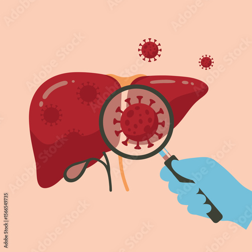 Human Liver Organ with Viruses Illustration, Medical Infection Concept