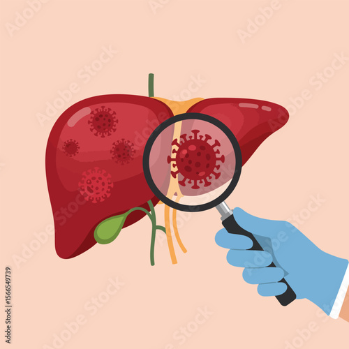 Human Liver Organ with Viruses Illustration, Medical Infection Concept