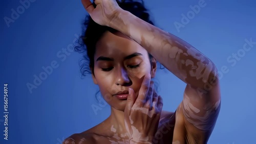 A serene young woman with vitiligo gently touches her face and neck, showcasing her unique skin patterns in a slow, graceful dance under dramatic lighting on a solid blue backdrop.
