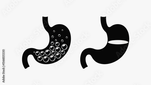 Two stomach illustrations showing gas bubbles and liquid level on a white background