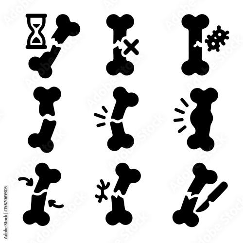 Bone Healing Challenges Icons. Solid, filled icons set of complications in bone healing: delayed union,