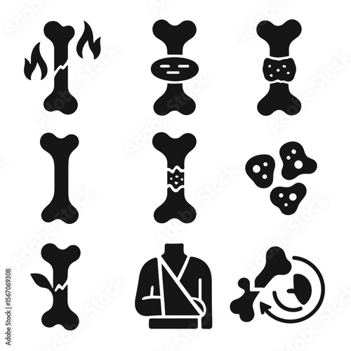 Bone Healing Icons. Solid, filled icons set of bone healing stages: inflammation phase, soft callus, hard