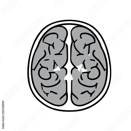 Top-down illustration of a human brain, highlighting a lesion or abnormality.