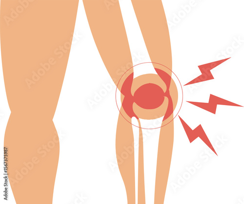 Knee pain illustration arthritis joint injury inflammation swelling medical condition healthcare treatment 