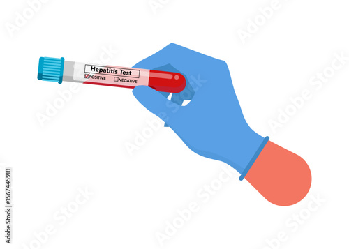 Hepatitis test vector stock illustration