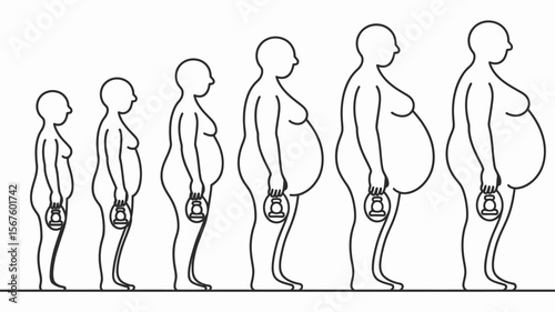 Weight Progression: A graphic illustration of a person's body transformation showcases the stages of weight gain over time.