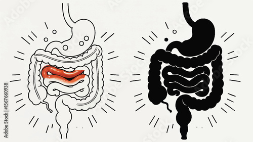 Stomach and intestines with inflamed section digestive system