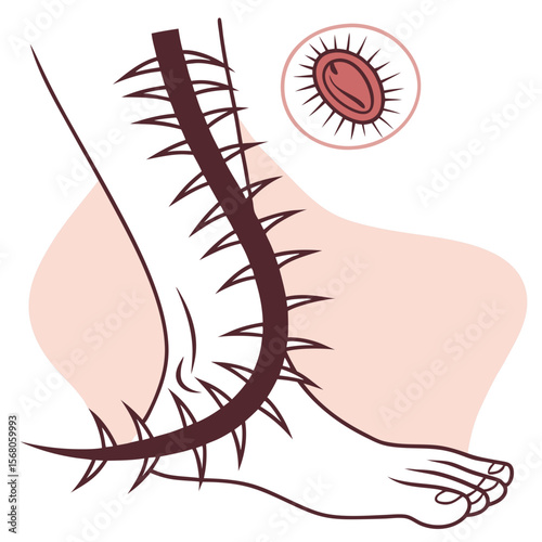  venomous spine prick
