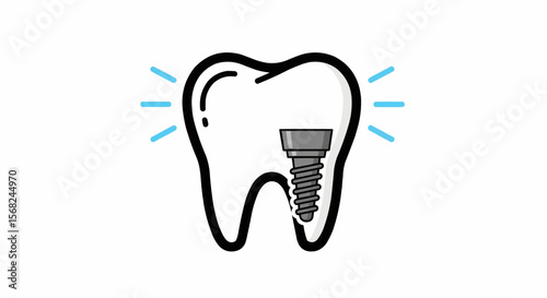 Illustration of a molar tooth with a dental implant and blue light accents on a white background