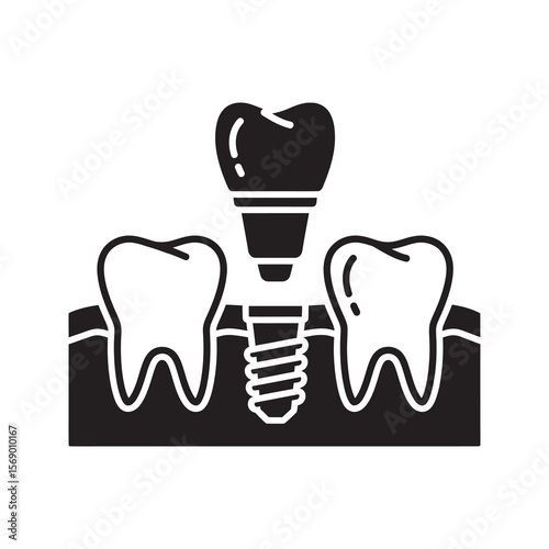 Dental implant in jaw icon with artificial tooth root representing prosthodontics surgery for permanent tooth replacement and oral reconstruction vector solid glyph