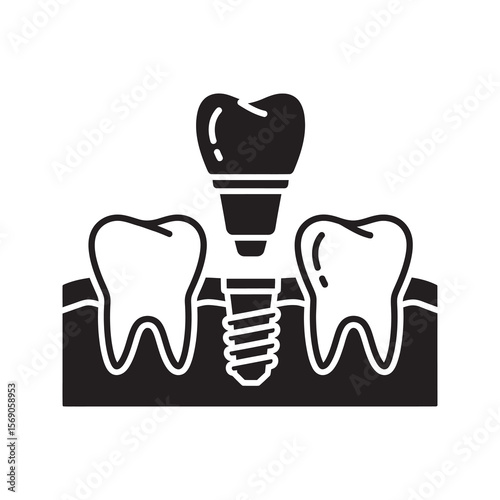 Dental implant in jaw icon with artificial tooth root representing prosthodontics surgery for permanent tooth replacement and oral reconstruction vector solid glyph