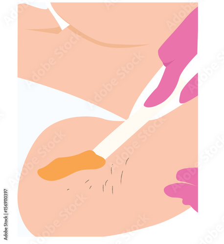underarm waxing. Failure with wax. Treatment of underarm hair