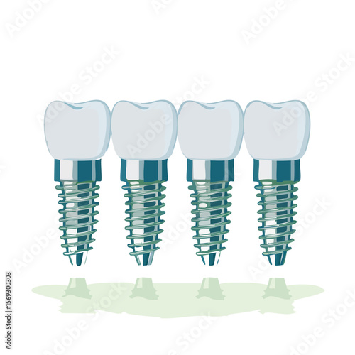 Dental Implants: Restoring Smiles with Modern Tooth Replacement