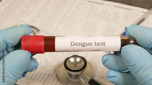 Doctor showing dengue fever test tube