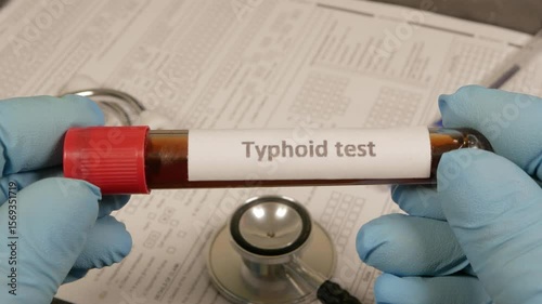 Doctor showing typhoid test tube in laboratory
