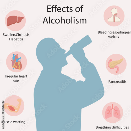 ChatGPT said:
Flat vector illustration showing effects of alcoholism: cirrhosis, weak muscles, strokes, breathing issues, pancreatitis, bleeding varices. Includes signs of liver, heart, and digestive 