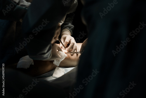 Closeup of endovenous laser catheter inserted into patient’s leg for varicose vein therapy