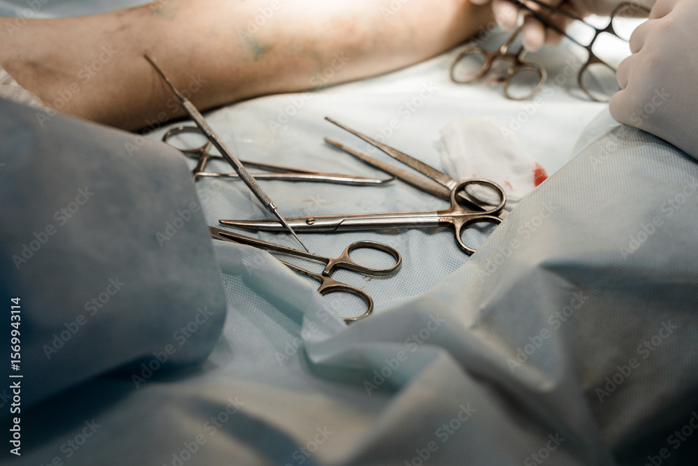 Fototapeta premium Close-up of sterile table with EVLA surgical instruments: scissors, catheter, laser fiber, antiseptic solutions, and syringes.
