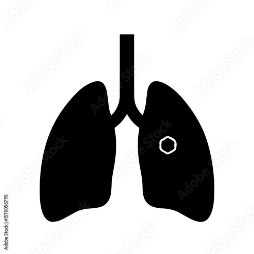 Human lungs illustration with a spot indicating lung cancer, illustrating lung cancer awareness. A spot alerts about possible diseases, promoting lung cancer prevention. Raises lung cancer awareness,