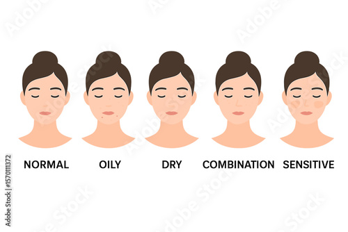 Types of women's skin issues include normal, oily, dry, combination, and sensitive, as depicted in a vector illustration on a white background