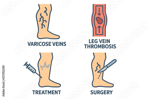 Vector symbols for varicose treatment, leg veins thrombosis disease, and surgery, along with icons for varicose or legs vascular varices circulation insufficiency, are available for medical treatment