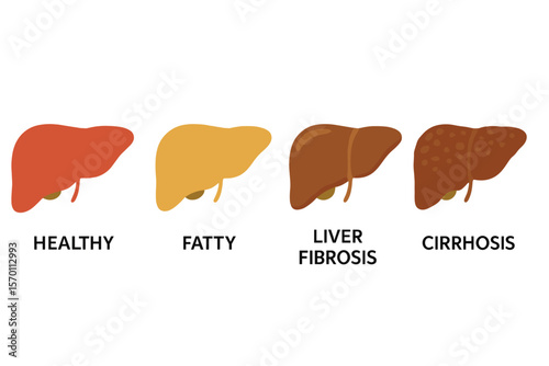The liver damage progression includes four stages: healthy, fatty, fibrosis, and cirrhosis