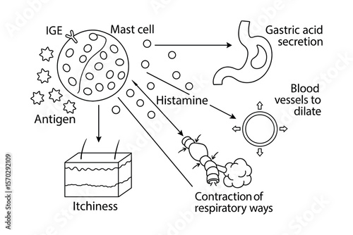 Allergic Reaction Diagram Showing Histamine Release and Bodily Responses