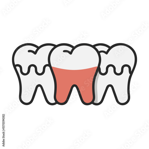 Dental Health Visual: Teeth Showing Gum Recession, Flat Illustration Style