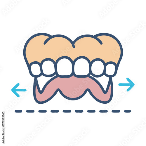 Graphic illustration of complete dentures showing lateral excursion movement