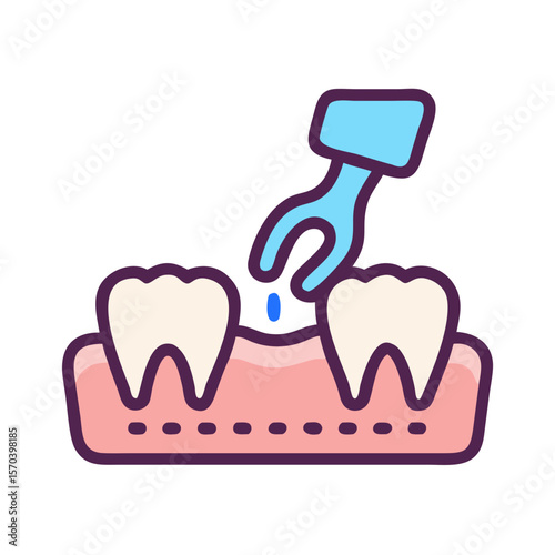Dental procedure illustration with probe treating inflamed gums