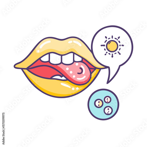 Illustration of oral thrush in mouth with fungal infection