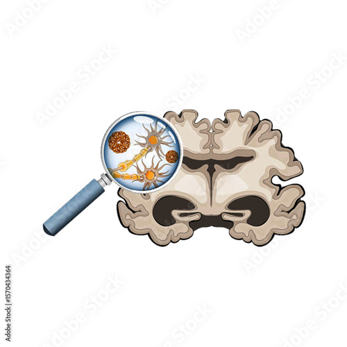 Alzheimer's disease icon
