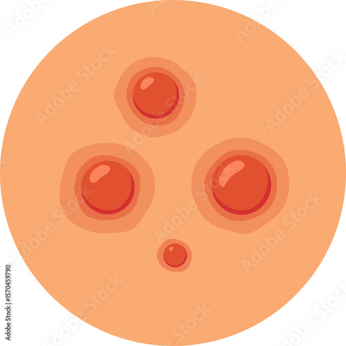 Pimples Skin Problem

