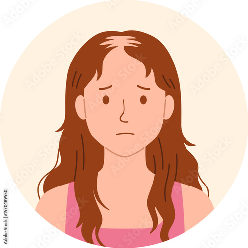 Baldness Hair Problem

