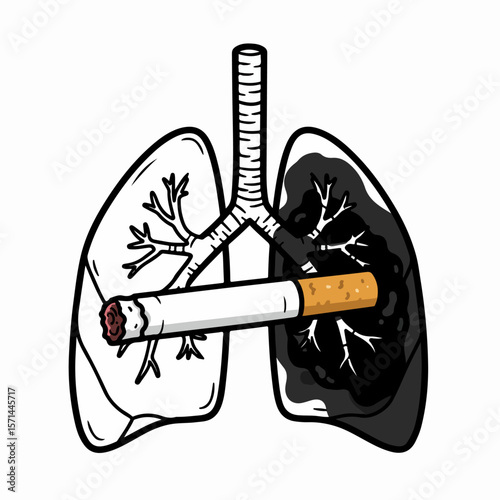 Cigarette effect depicted with diseased lungs against white background. Cigarette effect on lungs showcased by anatomical depiction of organ affected by tar, nicotine, and related diseases.