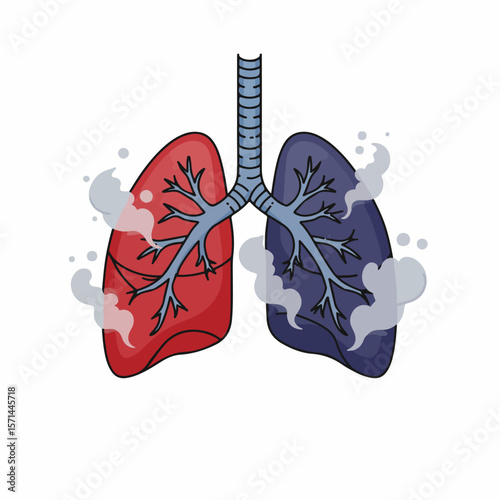 Illustration of affected lungs shows health effects. Affected lungs due to illnesses, smoking, or pollution harm respiratory functions and overall health.
