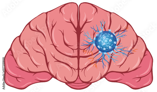 Human Brain with Neural Network Illustration