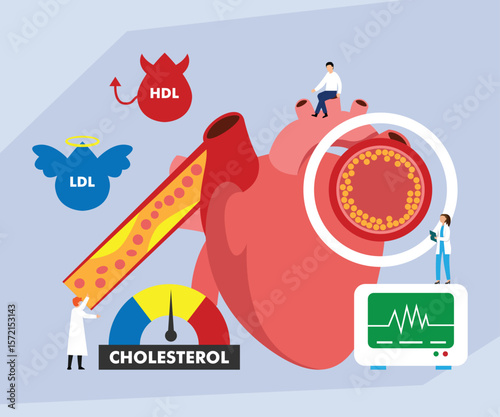 High Cholesterol and Heart Disease Risk Concept 2d flat vector illustrations