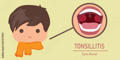 Flat vector illustration of a child with tonsillitis and inflamed red throat — educational medical concept of sore throat and throat infection in kids


