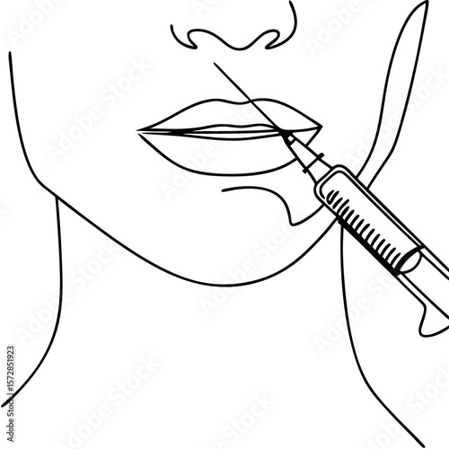 Chin injection with syringe, aesthetic procedure for facial contouring, and beauty enhancement detailed in line art. Chin injection with syringe addresses volume loss and wrinkles,