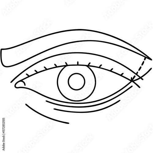 Eye area with surgical markings represents a procedure of blepharoplasty, which can improve vision and enhance the look of face. Eye area with surgical markings for rejuvenation, enhancing,