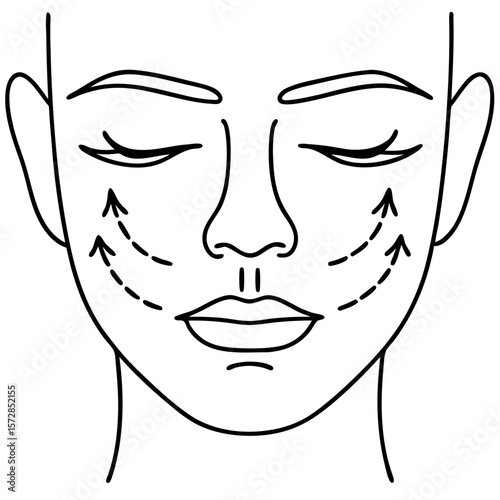 Face lift arrows indicating surgical direction on woman's face. Face lift arrows illustrate noninvasive cosmetic procedures, including microcurrent facelifts and face massage for skin tightening.