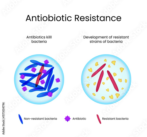 Antibiotic Resistance Development of Resistant Bacteria