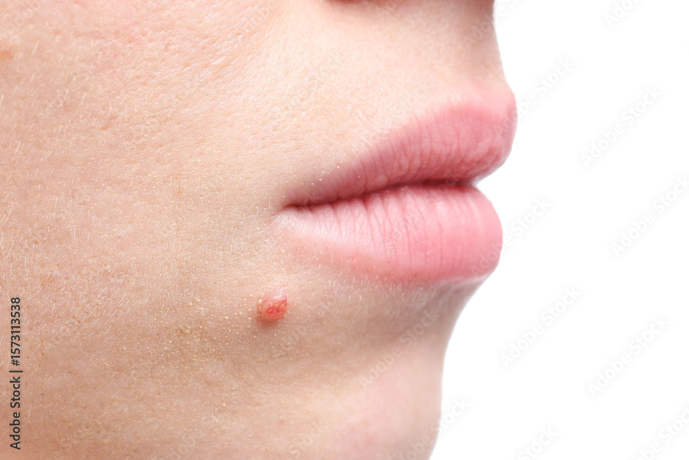 Obraz premium Woman with mole on her face against white background, closeup