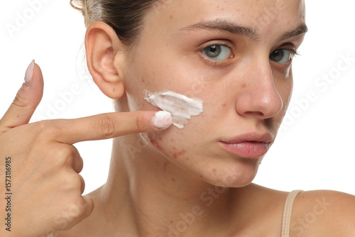 Serious young woman with acne applying cream to her face, studio shot on white background.